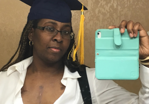 A Black woman wears her graduation cap & reveals her chest scar in a mirror selfie